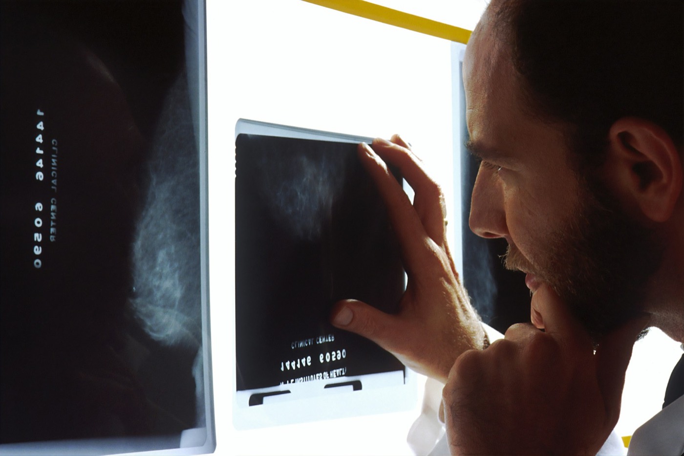 Someone holding a tablet that shows a medical scan